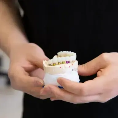 Modèle dentaire avec couronnes