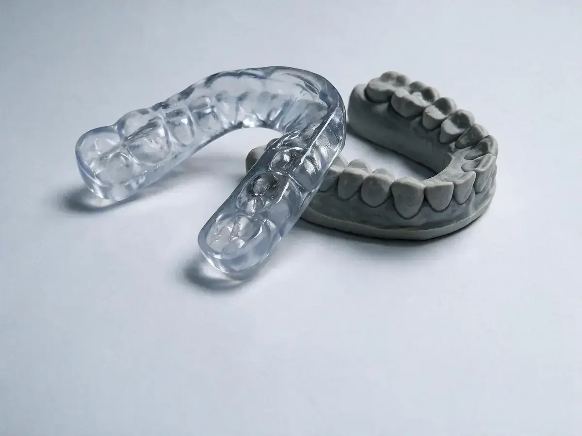 Plaque occlusale transparente sur mesure, à côté du modèle en plâtre du patient