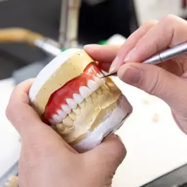 Technicien dentaire ajustant une prothèse sur un modèle en plâtre